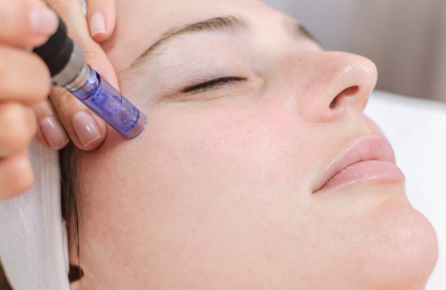 mesotherapy behandling