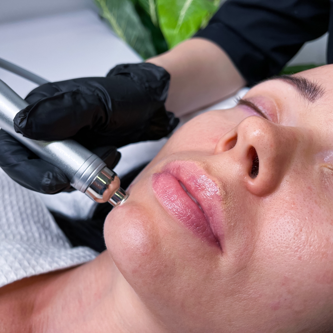 Hydrofacial behandling - Dermatherapy Odense